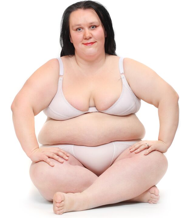 Overgewicht vrouw
